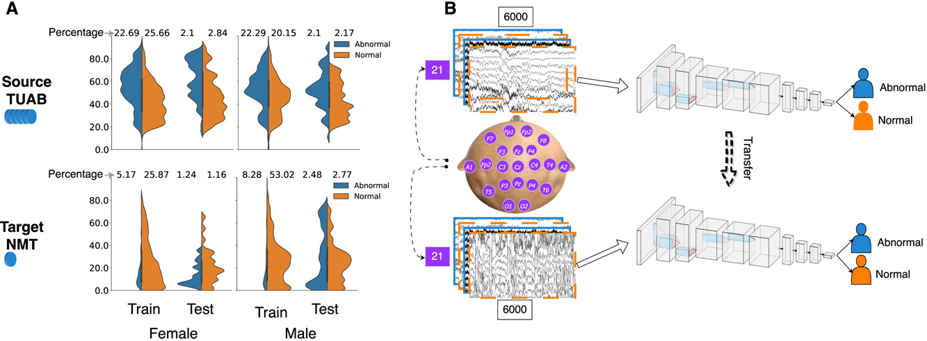 amplifying-pathological-detection-eeg-transfer-learning.png