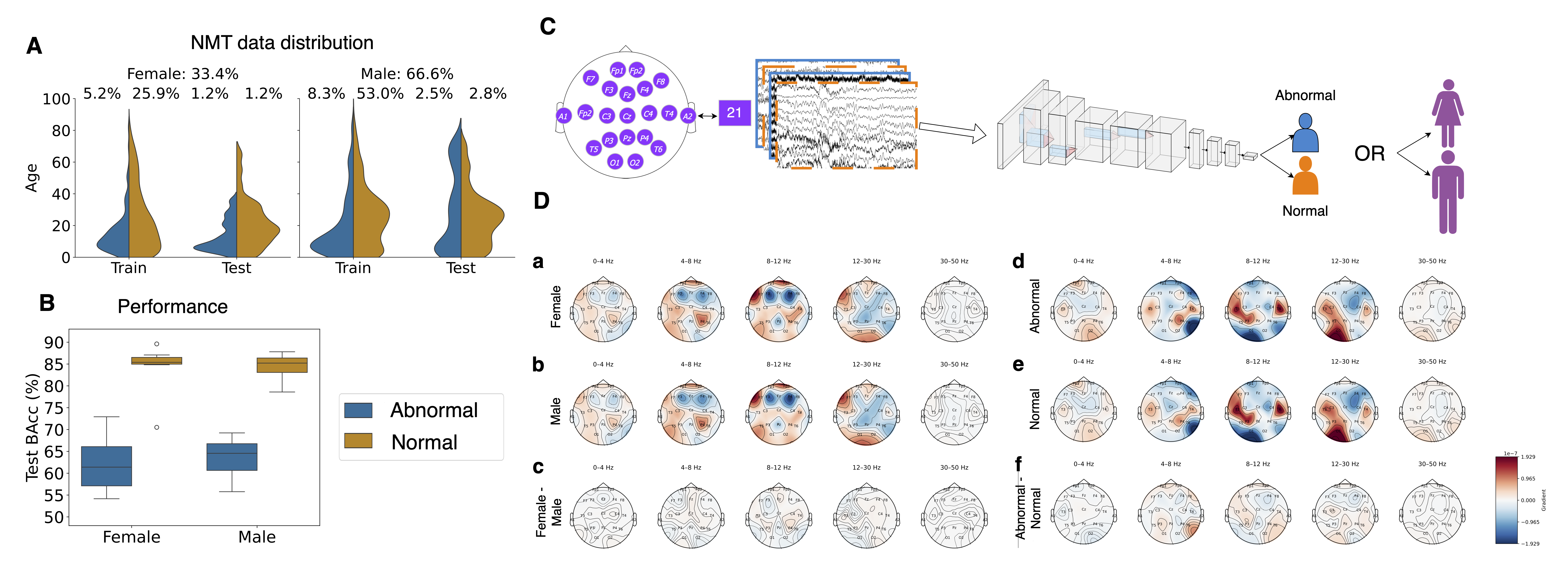 eeg-signals-sex-specific-neurological-diagnostics-machine-learning.png