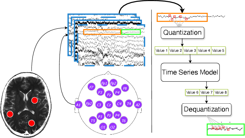 general-purpose-brain-foundation-models-time-series-neuroimaging.png